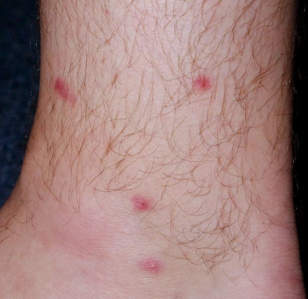 red dots on legs pictures 10
