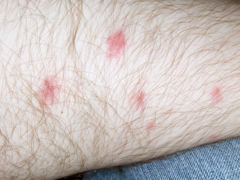 red dots on legs pictures 4