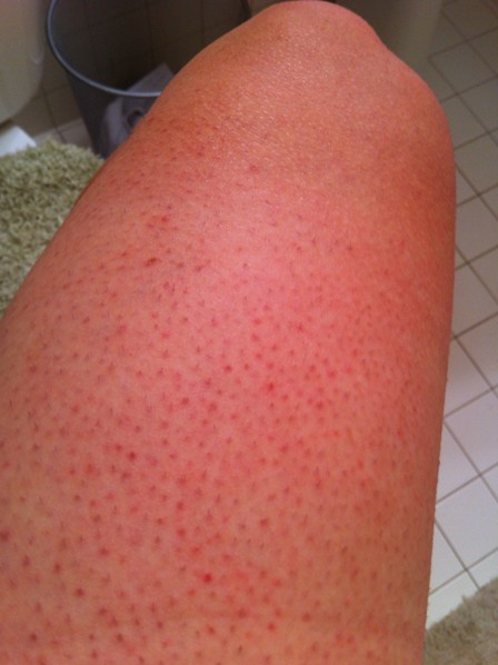 red dots on legs pictures 5