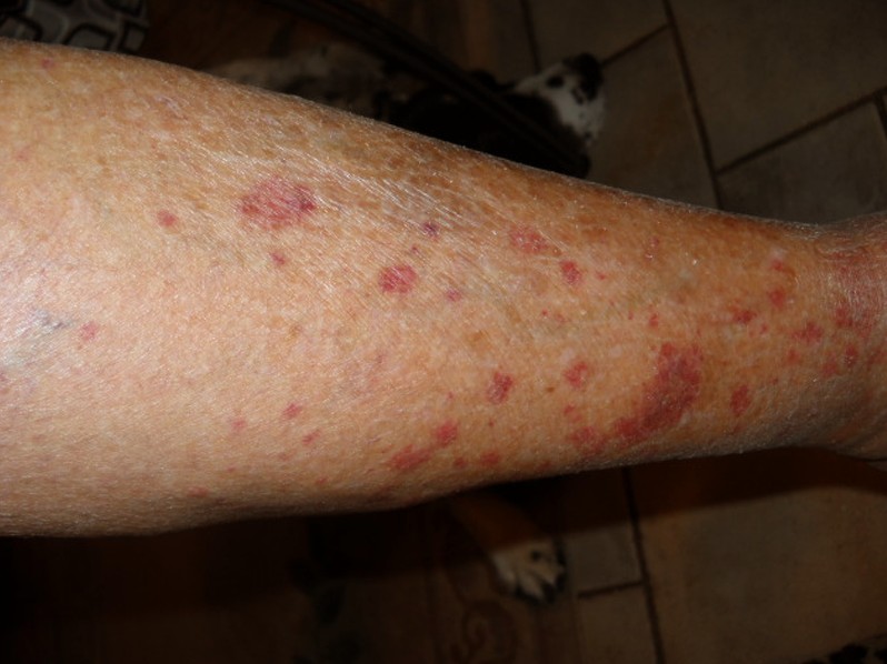 red dots on legs pictures 7