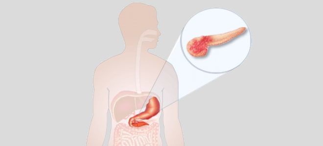 Значение диффузных изменений паренхимы поджелудочной железы