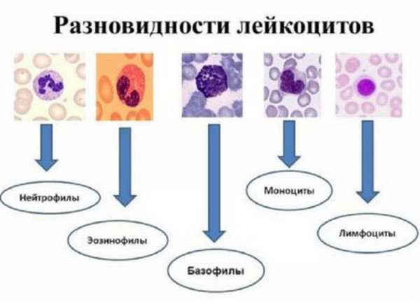 Почему повышаются лейкоциты в крови, основные причины и способы коррекции