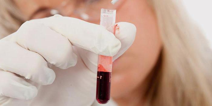 Лейкоцитарная формула крови сдвиги