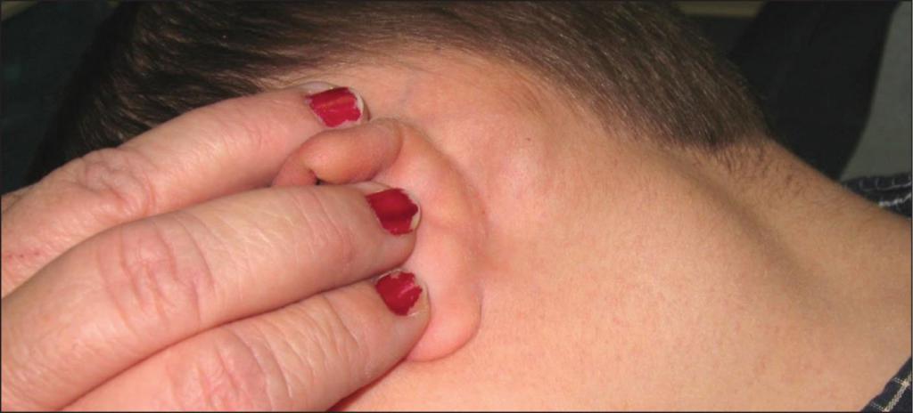 Воспаление за ухом