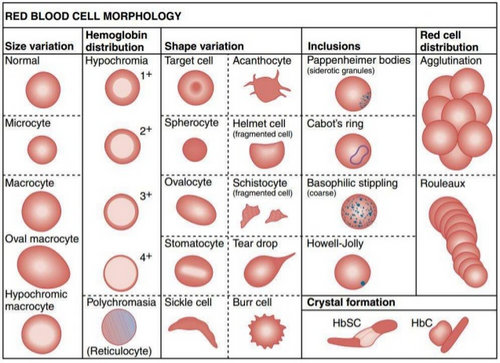 An illustration of red blood cells detailing the variation in size, shape, haemoglobin distribution, inclusions, and red cell distribution.photo