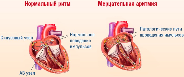 Лекарство для разжижения крови, укрепления стенок сосудов. Список нового поколения