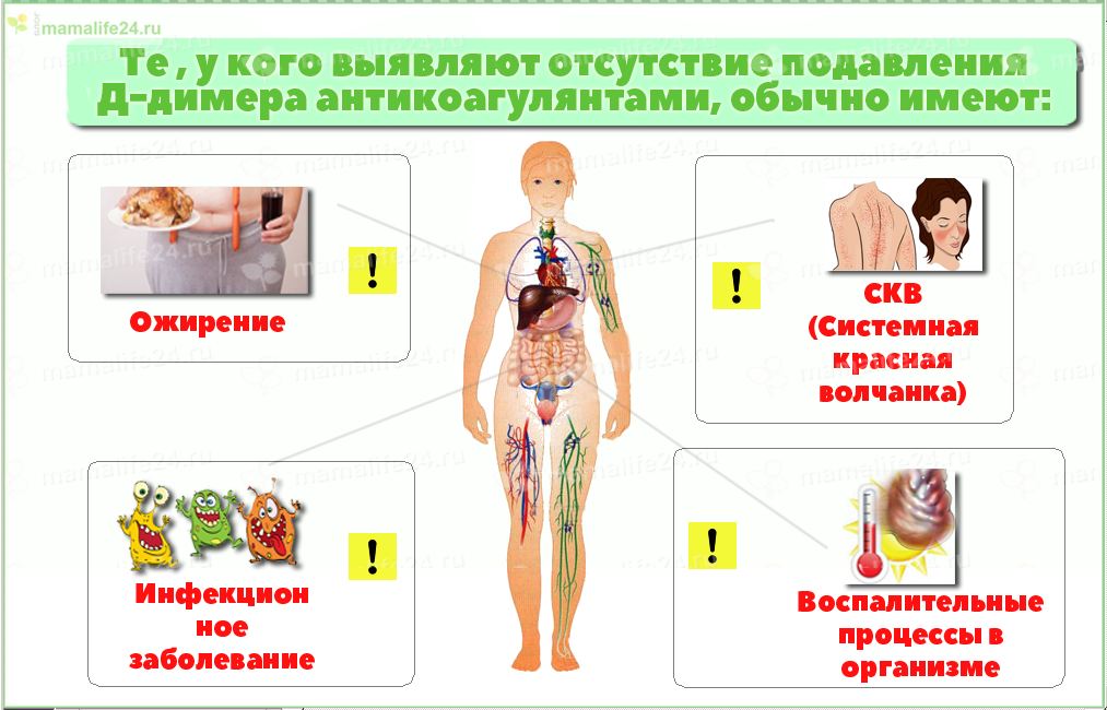 Те пациенты, у которых выявляют отсутствие подавления Д-димера антикоагулянтами, обычно имеют