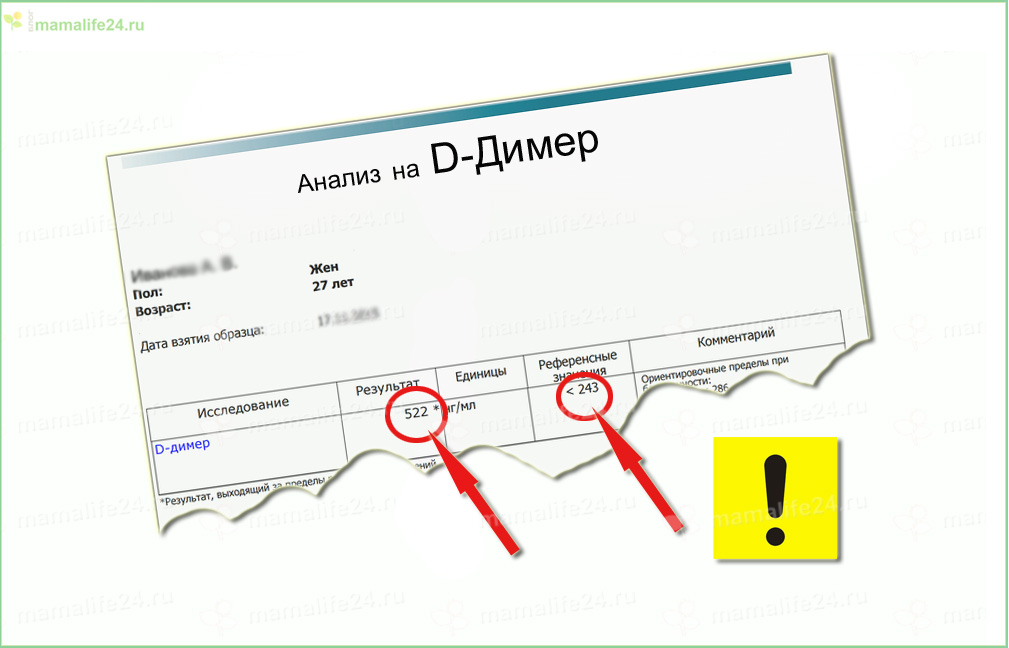 Д-димер выше нормы в анализе 