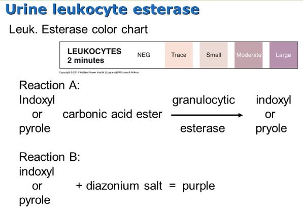 urine-leukocyte-esterase