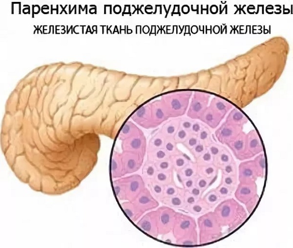 Диффузные изменения паренхимы поджелудочной железы