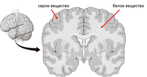 мозг на разрезе