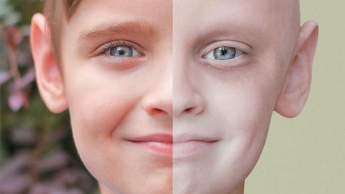 Детский рак – все о страшном заболевании маленьких людей