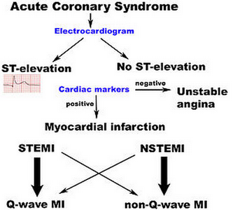 Acute Coronary Syndrome pathophysiology