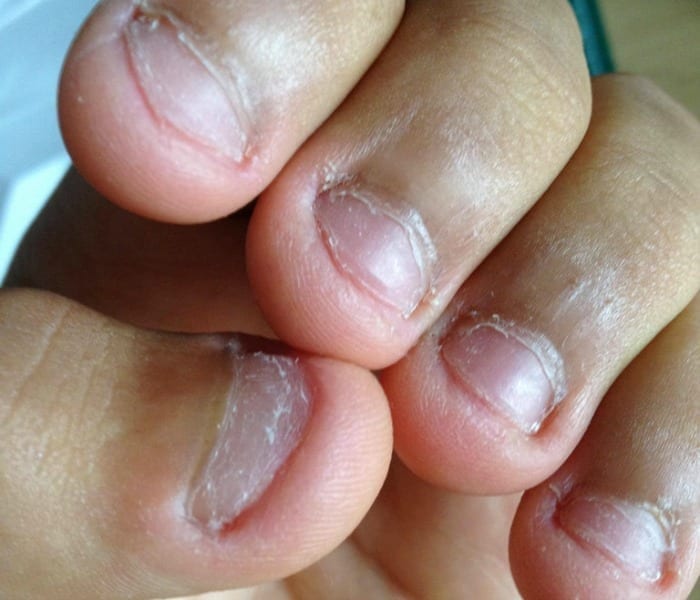 biting your nails is a bad habit, and could be a sign of anxiety or OCD