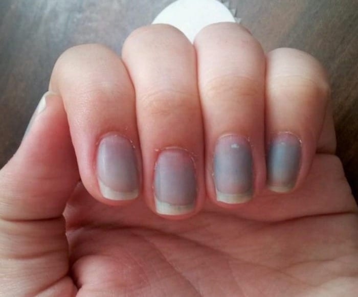 blue nails could be a sign of poor circulation in your body, nail polish stains, or could just mean you