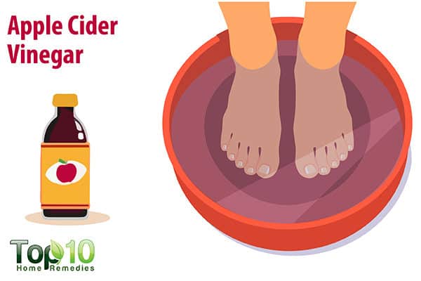 apple cider vinegar to relieve itchy feet